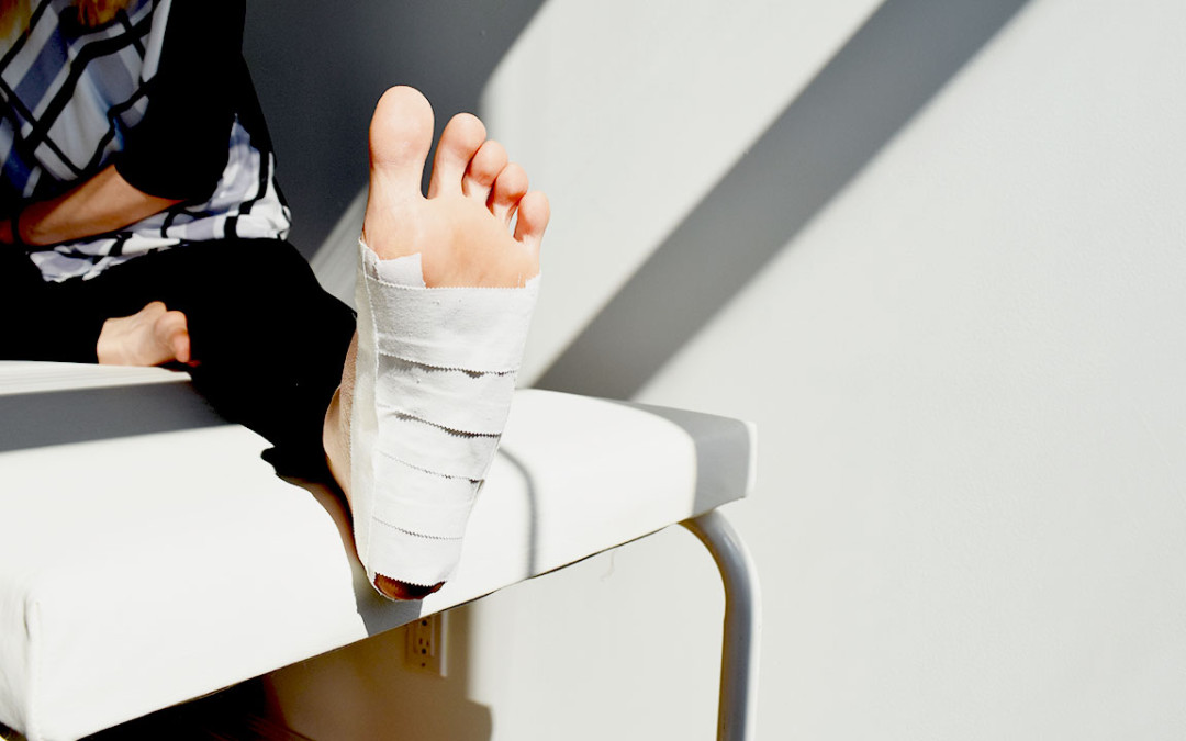 taping feet for heel pain